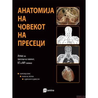 Атлас на човечката анатомија на пресеци, снимки кт и мр Медицина Kiwi.mk